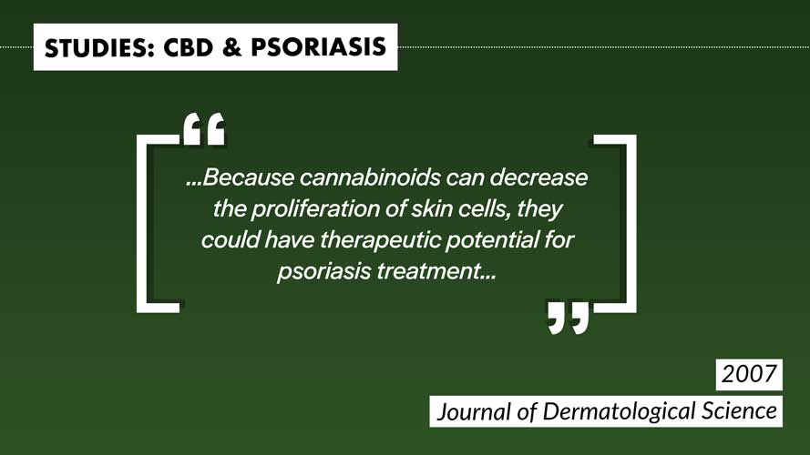 Psoriasis CBD Skin Treatment
