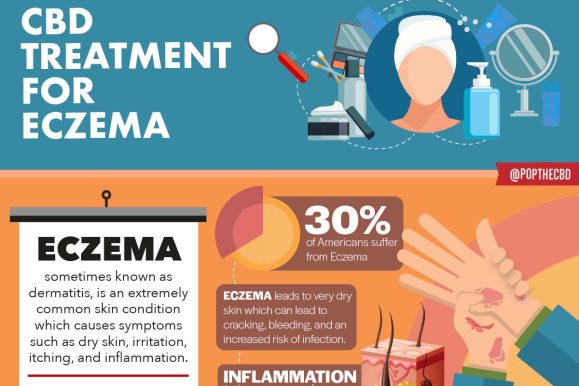 CBD for Eczema