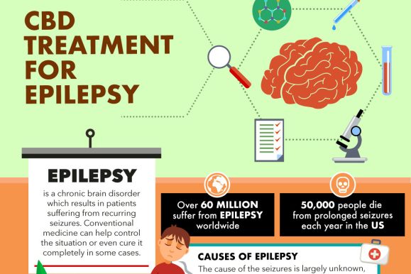 CBD Treatment for Epilepsy